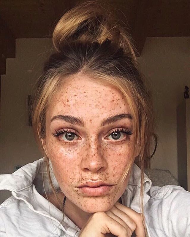 Swantje Paulina freckles