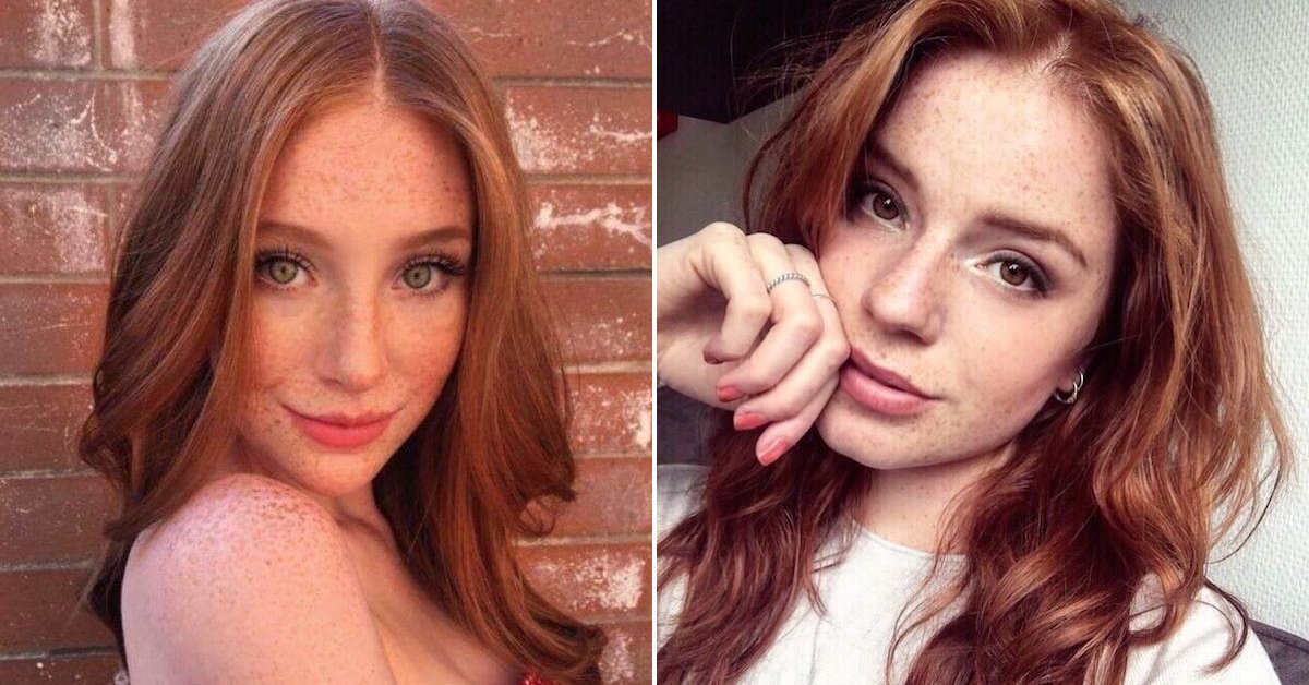 Freckles are like the sweetest drops of beauty from heaven (34 Photos) 68